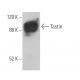 Tastin Antibody (H-1) - Western Blotting - Image 372008 