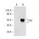 TAT Antibody (D-9) - Western Blotting - Image 141771 