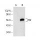 TAT Antibody (D-9) - Western Blotting - Image 141773 