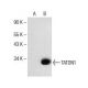 TATDN1 Antibody (B-2) - Western Blotting - Image 153772