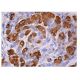 TATI Antibody (E-2) - Immunohistochemistry - Image 159117 