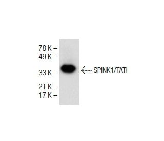 TATI Antibody (E-2) - Western Blotting - Image 150289 