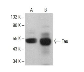 western blotting image from recommended Tau (Tau 46) monoclonal antibody replacement. Image 380253
