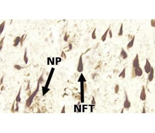 Tau Antibody (TauC3) - Immunohistochemistry - Image 9233 