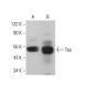 western blotting image from recommended Tau (Tau 46) monoclonal antibody replacement. Image 380253