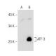Taurolidine: sc-202827. Western blot analysis of ATF-3 expression in untreated (A) and Taurolidine treated (B) HT-1080 who
