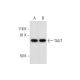 TAUT Antibody (A-11) - Western Blotting - Image 291996 