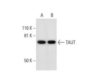 TAUT Antibody (A-11) - Western Blotting - Image 291996Each CRISPR/Cas9 Knockout (KO) Plasmid product consists of a pool of 3 plasmids designed to ensure identification and cleavage of a specific gene for maximum knockout efficiency. Each plasmid encodes a unique 20 nt sequence derived from the GeCKO (v2) library.