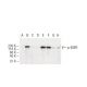Taxol: sc-201439. Western blot analysis of EGFR phosphorylation in serum starved Hep G2 whole cell lysate (A) and serum st