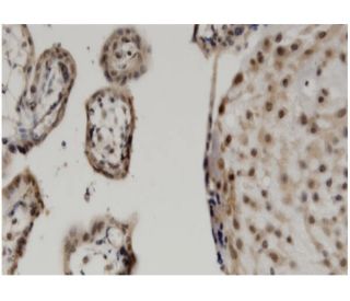 TAZ Antibody (1F1) - Immunohistochemistry - Image 346144 