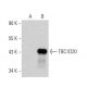 TBC1D20 Antibody (F-9) - Western Blotting - Image 358540
