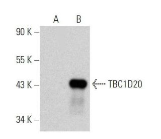 TBC1D20 Antibody (F-9) - Western Blotting - Image 358540SAM Transcription Activation: SAM system utilizing dCas9-VP64, MS2-P65-HSF1, and sgRNA for precise gene transcription activation. 