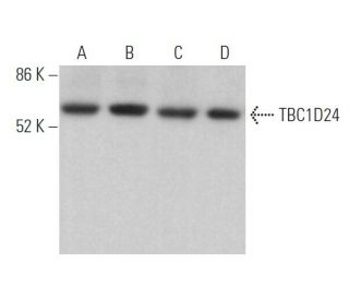 TBC1D24 Antibody (D-5) - Western Blotting - Image 373172 