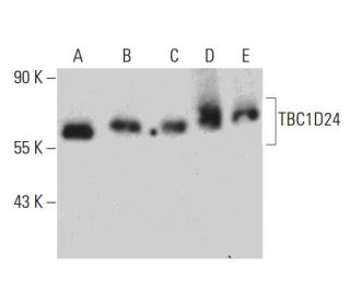 TBC1D24 Antibody (G-6) - Western Blotting - Image 386865 