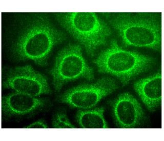 TBC1D2B Antibody (E-8) - Immunofluorescence - Image 318880 