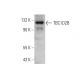 TBC1D2B Antibody (G-10) - Western Blotting - Image 346551 