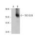 TBC1D2B Antibody (G-10) - Western Blotting - Image 387357