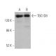 TBC1D8 Antibody (B-5) - Western Blotting - Image 368391 