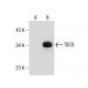 TBCB Antibody (B-12) - Western Blotting - Image 281841