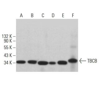TBCB Antibody (E-1) - Western Blotting - Image 382611 
