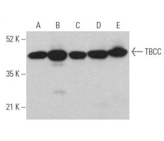 TBCC Antibody (G-10) - Western Blotting - Image 370145 