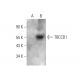 TBCCD1 Antibody (D-2) - Western Blotting - Image 344314
