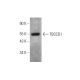 TBCCD1 Antibody (D-2) - Western Blotting - Image 344315 