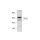 TBCE Antibody (D-11) - Western Blotting - Image 301534