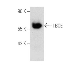 TBCE Antibody (D-11) - Western Blotting - Image 388960 