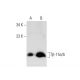 Tβ-15a/b Antibody (B-4) - Western Blotting - Image 135494 