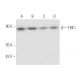 TBK1 Antibody (6D603) - Western Blotting - Image 17594