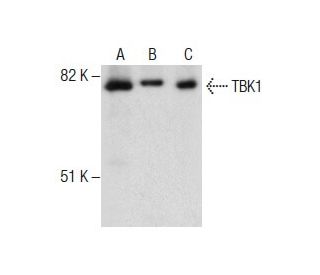 TBK1 Antibody (6D603) - Western Blotting - Image 287542 