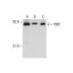 TBK1 Antibody (6D603) - Western Blotting - Image 287542 