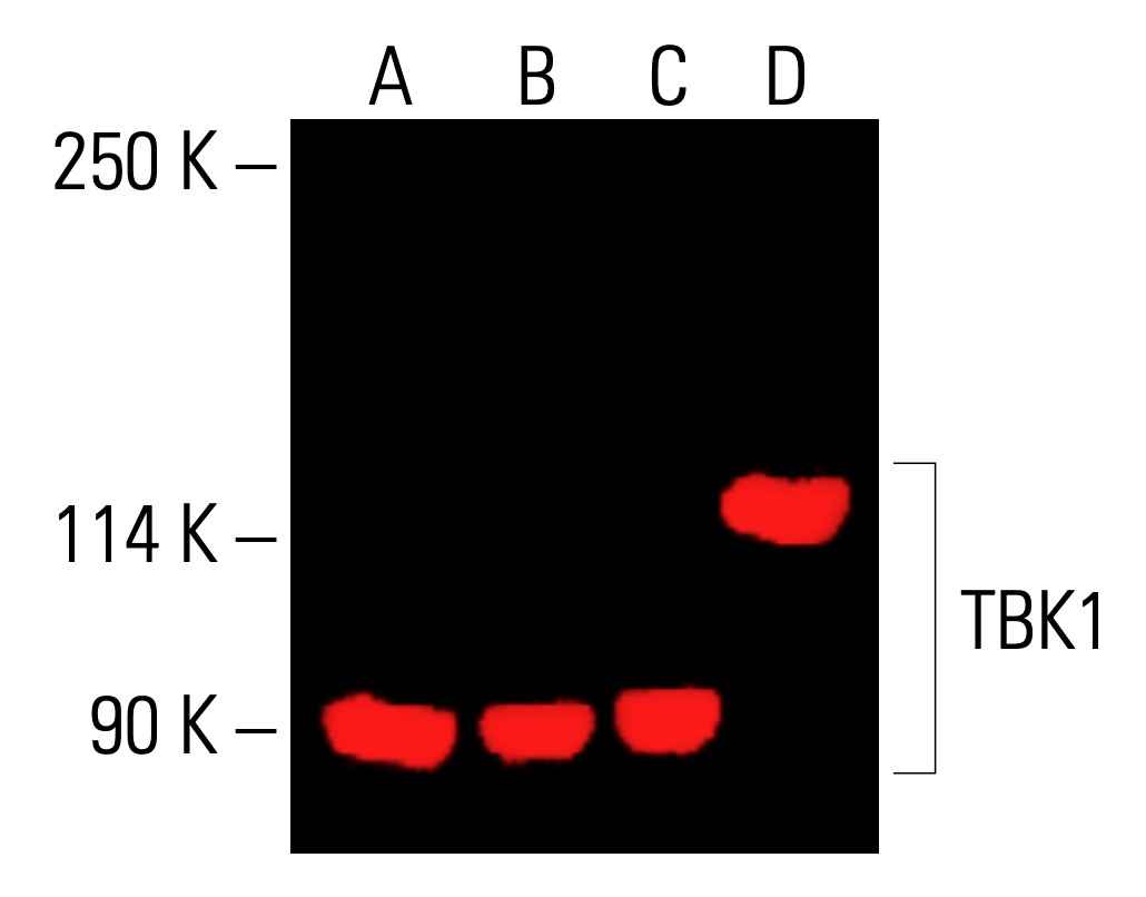 TBK1 Antibody (A-6) | SCBT - Santa Cruz Biotechnology