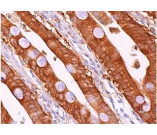 immunohistochemistry image from recommended TBK1 (A-6) monoclonal antibody replacement. Image 368918
