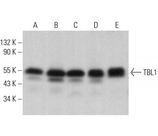 TBL1 Antibody (H-11) - Western Blotting - Image 382107 