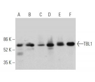 TBL1 Antibody (H-3) - Western Blotting - Image 362496 