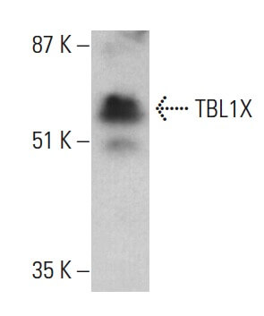 Anti-TBL1X Antibody (F-2) | SCBT - Santa Cruz Biotechnology