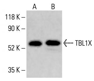 TBL1X Antibody (F-2) - Western Blotting - Image 414384 