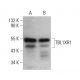 TBL1XR1 Antibody (AP-86) - Western Blotting - Image 384039