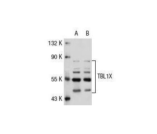 TBL1XR1 Antibody (L-08) - Western Blotting - Image 32561 