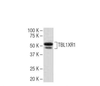 TBL1XR1 Antibody (L-08) - Western Blotting - Image 34278Each CRISPR/Cas9 Knockout (KO) Plasmid product consists of a pool of 3 plasmids designed to ensure identification and cleavage of a specific gene for maximum knockout efficiency. Each plasmid encodes a unique 20 nt sequence derived from the GeCKO (v2) library.