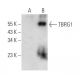 TBRG1 Antibody (D-9) - Western Blotting - Image 353741