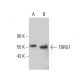 TBRG1 Antibody (D-9) - Western Blotting - Image 387360 
