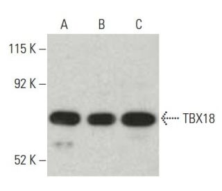 western blotting image from recommended TBX18 (CD-21) monoclonal antibody replacement. Image 397514