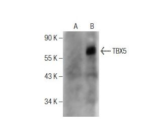 TBX5 Antibody (A-4) - Western Blotting - Image 160768