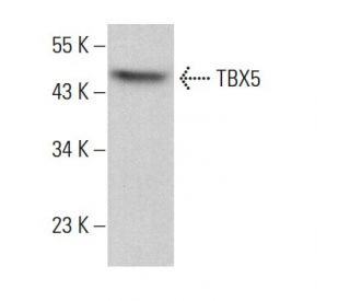 TBX5 Antibody (A-6) - Western Blotting - Image 381963 