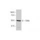 TBX6 Antibody (1D11) - Western Blotting - Image 352145 