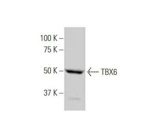 TBX6 Antibody (1D11) - Western Blotting - Image 352145Each CRISPR/Cas9 Knockout (KO) Plasmid product consists of a pool of 3 plasmids designed to ensure identification and cleavage of a specific gene for maximum knockout efficiency. Each plasmid encodes a unique 20 nt sequence derived from the GeCKO (v2) library.
