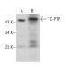 TC-PTP Antibody (E-11) - Western Blotting - Image 381460 